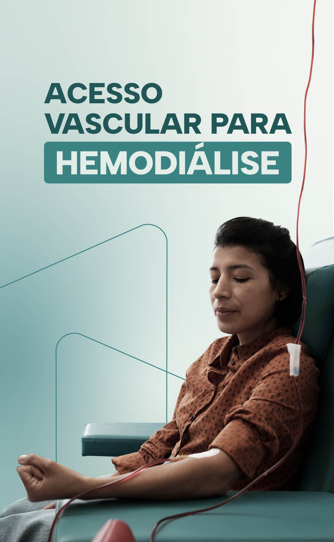 Acesso vascular para Hemodiálise