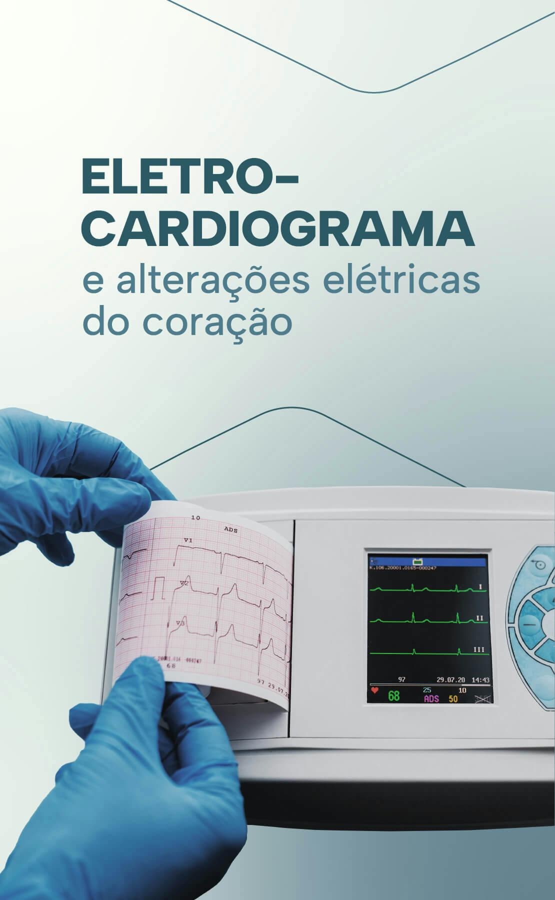 Eletrocardiograma e alterações elétricas do coração